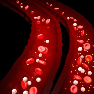 diabetes-shutterstock