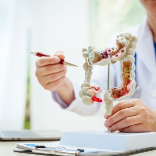 Ein Arzt zeigt den Darm an einem Modell