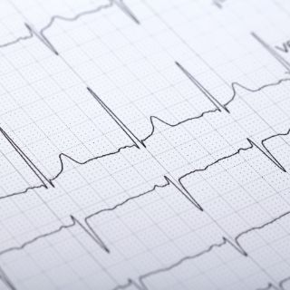 Das Motiv zeigt ein EKG